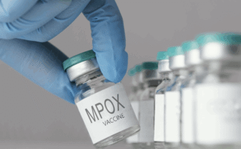 Mpox Outbreak in Sierra Leone